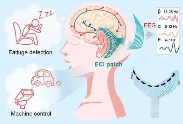 耳后脑机接口贴片问世，北理工、北航团队打造