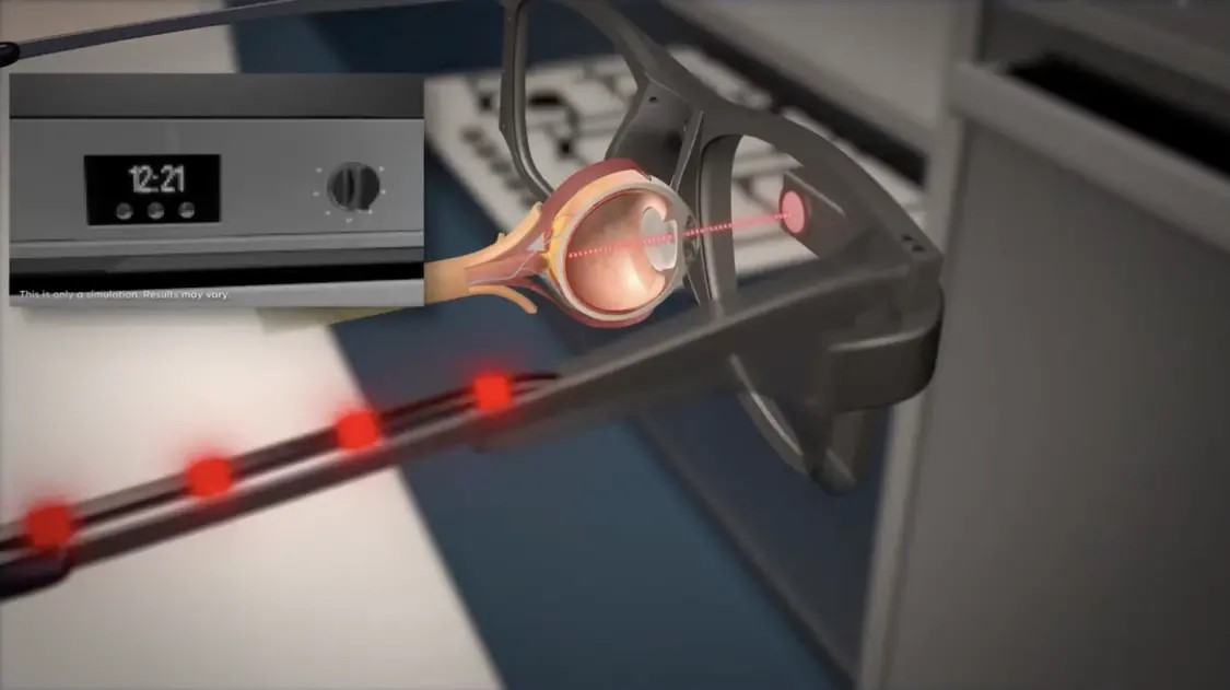 英國(guó)團(tuán)隊(duì)研發(fā)PRIMA電子眼，臨床試驗(yàn)84%失明患者恢復(fù)閱讀能力